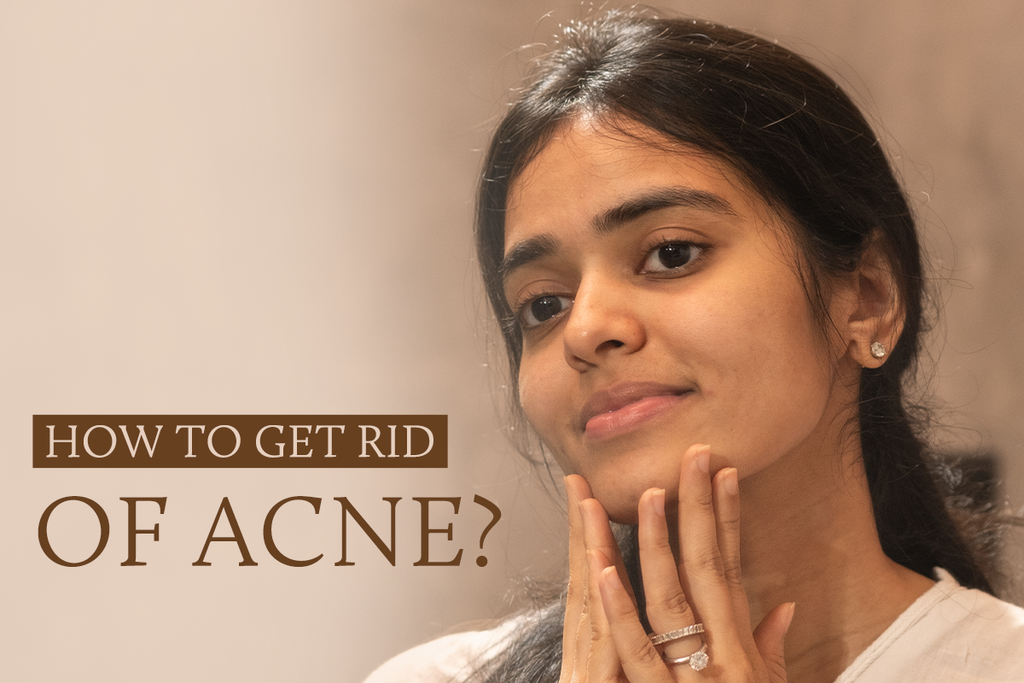 How to Get Rid of Acne? Effective Natural Remedies