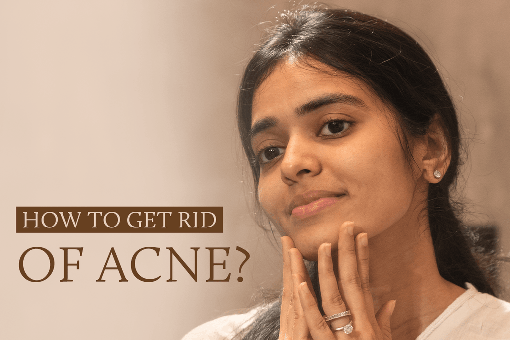 How to Get Rid of Acne? Effective Natural Remedies