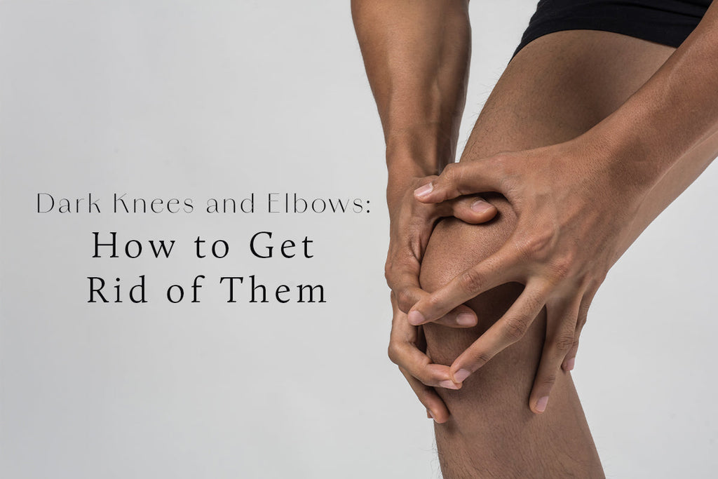 Dark Knees and Elbows: How to Get Rid of Them